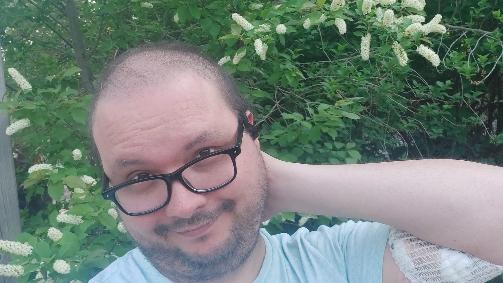 A man wearing a blue shirt stands in front of a bush, left hand behind his head, and PICC visible